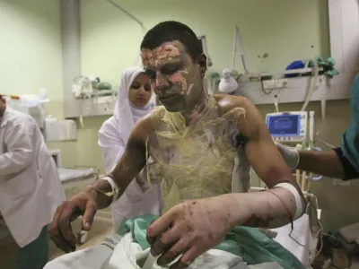 ** EDS NOTE GRAPHIC CONTENT ** Palestinian Akram Abu Roka is treated for burns at Nasser Hospital in Khan Younis in the southern Gaza Strip, Sunday, Jan. 11, 2009. The hospital's chief doctor said the injuries might have been caused by munitions containing white phosphorus. Human Rights Watch said Sunday that Israel's military has fired artillery shells packed with the incendiary agent over populated areas of Gaza, putting civilians at risk. (AP Photo/Eyad Baba)
