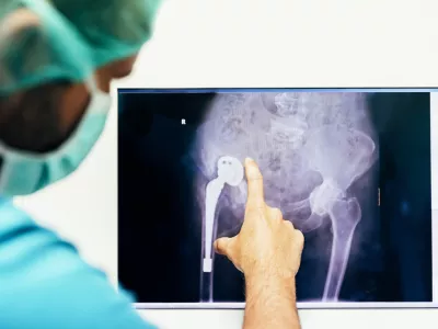 Pregled rentgenske slike pred operacijo. / Foto: Istock