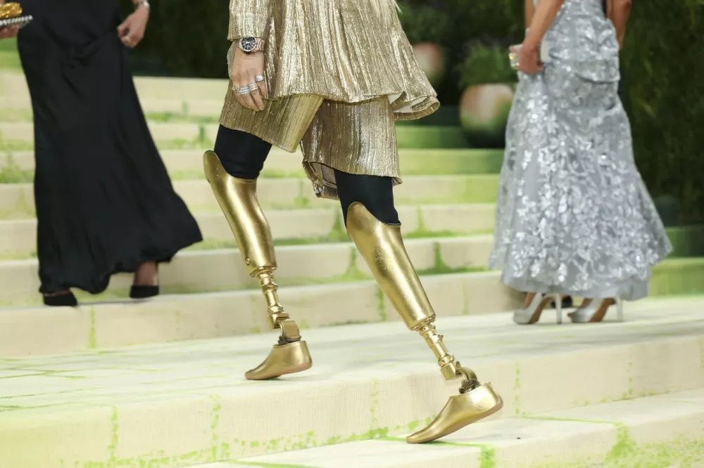 US model activist Lauren Wasser arrives for the 2026 Met Gala celebrating "Costume Art" at the Metropolitan Museum of Art, in New York, on May 4, 2026.,Image: 1096553043, License: Rights-managed, Restrictions:, Model Release: no