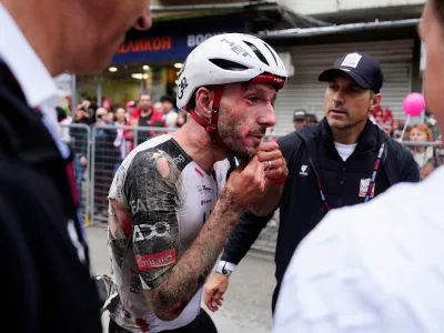 Britain's Adam Yates, his face bleeding, after completing the second stage of the Giro d'Italia cycling race, from Burgas to Veliko Tarnovo, Bulgaria, Saturday, May 9, 2026. (Gian Mattia d'Alberto/LaPresse via AP)