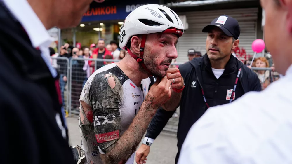 Britain's Adam Yates, his face bleeding, after completing the second stage of the Giro d'Italia cycling race, from Burgas to Veliko Tarnovo, Bulgaria, Saturday, May 9, 2026. (Gian Mattia d'Alberto/LaPresse via AP)