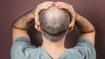 Self-doubt and inferiority complex. Baldy adult man grabs his head with his hands. Rear view. Brown background. The concept of alopecia and baldness. / Foto: Ildar Abulkhanov