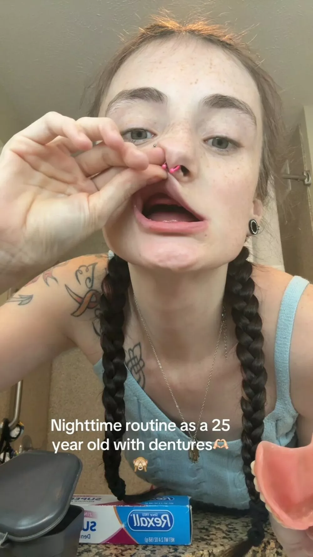 WARNING, GRAPHIC CONTENTStory from Jam Press (Horror Teeth Story) Pictured: Video grab - Becca shows her nighttime routine with dentures, including removing, cleaning and reinserting them.'I lost all my teeth at 25 due to vitamin deficiency &ndash; doctors thought I was a meth user and now that I have dentures trolls say I look 50 years older'A young woman who lost all her teeth from a nutritional deficiency gets trolled by haters who say she looks 50 years older and must have been a hard drug user.Becca [surname not shared for privacy reasons] was in pain and suffered awkward stares from strangers for years, and had to avoid foods due to her raw gums and rotten teeth.She was shocked when, aged just 22, doctors recommended that she have all of them removed and replaced with dentures.It's been a difficult journey, with the now 25-year-old having to relearn how to talk and eat, and she still suffers comments from people online when sharing her story."Life before I lost all my teeth was hard," Becca, a nanny, told creatorzine.com."I was in constant pain and couldn't eat a lot of the things I love."I was constantly having to ice my face and a lot of the time it was swollen."People looked at me weird because my teeth were really bad and everyone thought I had done hard drugs."Doctors said I must have used crystal meth &ndash; but I hadn't and I never would."I lost a lot of my confidence and wasn't smiling very often, and I learned to talk in a way that didn't show my teeth very much."I didn't have access to dental care when I was younger but my teeth didn't start getting really bad until I was around 18 and it progressed from there."When I was 22, I was diagnosed with severe vitamin deficiencies: vitamin b12, vitamin D, iron, vitamin C."It only took one procedure to get them all pulled &ndash; the whole procedure took about nine hours."After I got my teeth pulled, I had to learn to talk again and eat again and my confidence took a hit there too, until my dentures were made to fit my mouth the right way."Becca, who hails from Indiana, says the surgery was offered to her free of charge by the VCU School of Dentistry &ndash; though the dentures cost,000 (USD).She had to wait two months for her mouth to fully heal before having dentures made.Unfortunately, the first set was too big, which at first left her feeling distraught.She said: "When they gave me the big ones, I had a breakdown, because I thought I'd never be able to truly smile again."That was really hard for me."They had to make me one more set of temporary dentures, which I wore for about eight months &ndash;&nbsp;then I got my permanents."I love the way my teeth look now."Having dentures has finally given me my confidence back."But there are still challenges."I've had a few people comment on my videos and tell me I look 75 or that it's disgusting saying I'm 'too young to have dentures'."In the past, I also dated someone who was embarrassed I had dentures and that really made me self-conscious."My current partner is very supportive, as are my friends."Becca wants to share her story to help others.She added: "I've been posting a lot about my dentures trying to give insight and help others going through the same thing and I've been able to help a handful of people already."There are over 40 million people in the United States who have dentures."The majority of that is not from drugs &ndash; it's from common dental diseases, genetics, health issues, ageing and accidents."I want to bring light to something that a lot of people deal with and to be able to be the voice for people who can't speak for themselves."ENDSEDITOR'S NOTE: Becca is not sharing her surname for privacy reasons.Exclusive Licence: An exclusive licence has been obtained directly from the verified copyright holder. Jam Press holds exclusive distribution rights for the agreed content within the terms of the contributor agreement.,Image: 1107840060, License: Rights-managed, Restrictions: EDITOR'S NOTE: Becca is not sharing her surname for privacy reasons.Exclusive Licence: An exclusive licence has been obtained directly from the verified copyright holder. Jam Press holds exclusive distribution rights for the agreed content within the ter, Model Release: no 