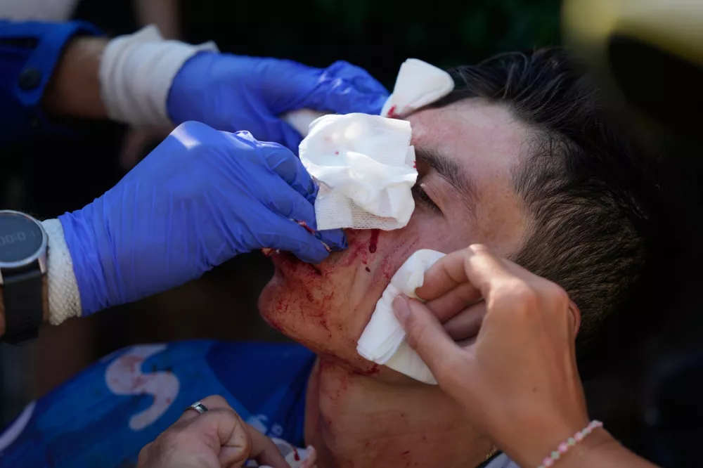 Colombia's Einer Rubio receives medical attention during the nineteenth stage of the Tour de France cycling race with start in Gap and finish in Alpe d'Huez, France, Friday, July 24, 2026. (AP Photo/Mosa'ab Elshamy)