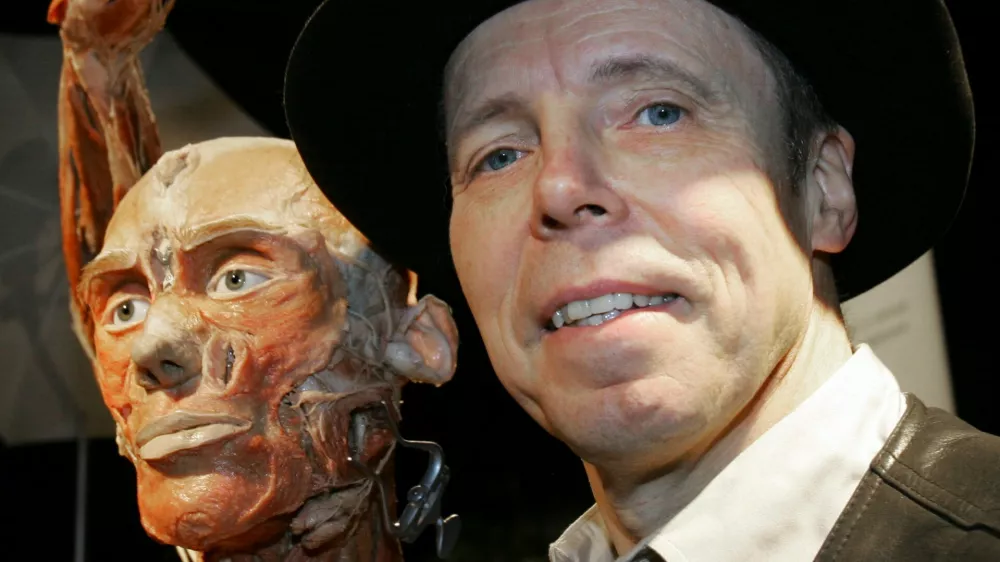 FILE - German Gunther von Hagens poses with a display from "Body Worlds" anatomy exhibit that puts real human specimens on show in Dallas, Texas, Jan. 23, 2007. (AP Photo/LM Otero, File)