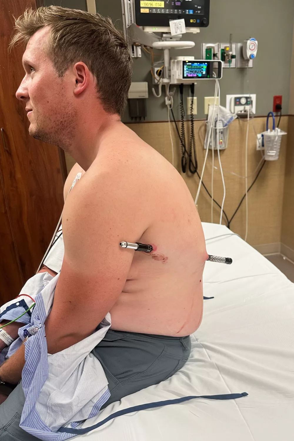 This photo provided by David Cifaldi shows Cifaldi while he was being treated Monday, July 20, 2026, at St. Vincent Regional Hospital in Billings, Mont. (Jesse Ross via AP)