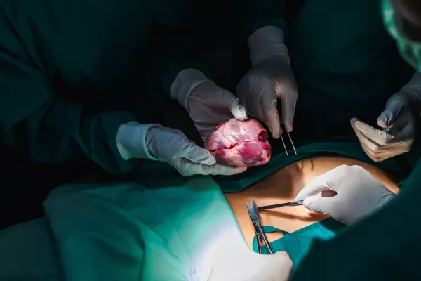 Simbolična slika operacije zamenjave srca. / Foto: Istock