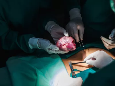 Simbolična slika operacije zamenjave srca. / Foto: Istock
