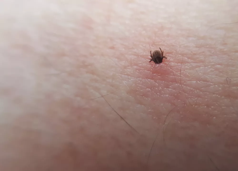 Tick Ixodes ricinus on human skin. tick wandering over human hand. Encephalitis tick