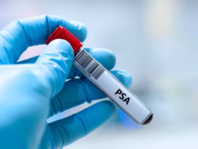 PSA test, prostata