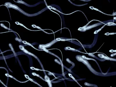 Spermiji pod mikroskopom / Foto: Istock