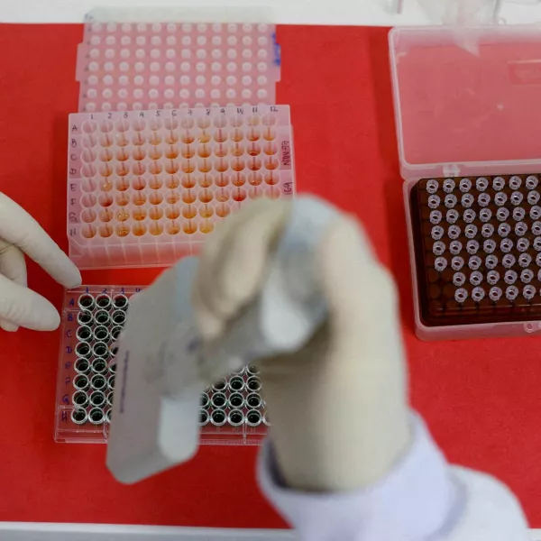 FILE PHOTO: An employee dilutes poultry serum samples for ELISA test for the detection of antibodies to the avian influenza virus at the Reference Laboratory of the World Organization for Animal Health in Campinas, Brazil April 25, 2023. REUTERS/Amanda Perobelli/File Photo