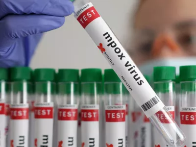 FILE PHOTO: A test tube labelled "Mpox virus positive" is held in this illustration taken August 20, 2024. REUTERS/Dado Ruvic/Illustration/File Photo