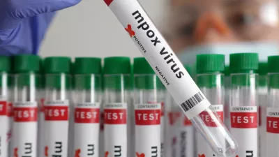 FILE PHOTO: A test tube labelled "Mpox virus positive" is held in this illustration taken August 20, 2024. REUTERS/Dado Ruvic/Illustration/File Photo