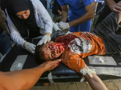 DEIR AL-BALAH, GAZA - AUGUST 31: An injured child, is brought to Al-Awda Hospital to receive medical treatment after Israeli forces hit Nuseirat Refugee Camp in Deir al-Balah, Gaza on August 31, 2024. Ashraf Amra / AnadoluNo Use USA No use UK No use Canada No use France No use Japan No use Italy No use Australia No use Spain No use Belgium No use Korea No use South Africa No use Hong Kong No use New Zealand No use Turkey