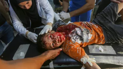 DEIR AL-BALAH, GAZA - AUGUST 31: An injured child, is brought to Al-Awda Hospital to receive medical treatment after Israeli forces hit Nuseirat Refugee Camp in Deir al-Balah, Gaza on August 31, 2024. Ashraf Amra / AnadoluNo Use USA No use UK No use Canada No use France No use Japan No use Italy No use Australia No use Spain No use Belgium No use Korea No use South Africa No use Hong Kong No use New Zealand No use Turkey