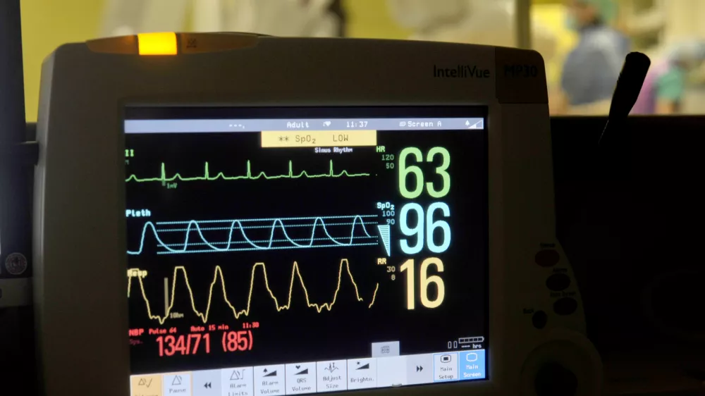 - ilustrativna fotografijazdravstvene preiskave, zdravstveni pregled, radiologija, bolnišnica, zdravje, merjenje vitalnih znakov, monitor, medicina- Klinični inštitut za radiologijo UKC v Ljubljani ob mednarodnem dnevu radiologije predstavili nove metode zdravljenja;//FOTO: Tomaž Zajelšnik