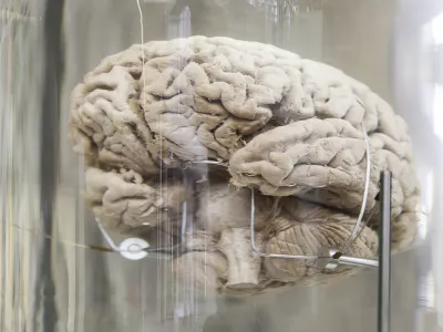 ﻿Human brain, detail of a human organ, intelligence and thought