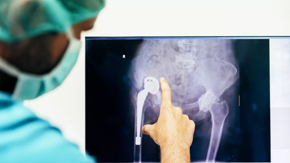 Pregled rentgenske slike pred operacijo. / Foto: Istock
