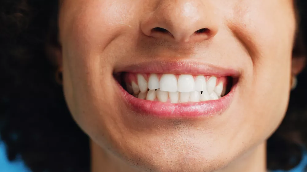 Person, teeth and mouth with smile for dental clean, hygiene or oral and gum care treatment. Closeup, lips and tooth whitening with dentist for cavity or plaque removal on a blue studio background / Foto: Jacob Wackerhausen