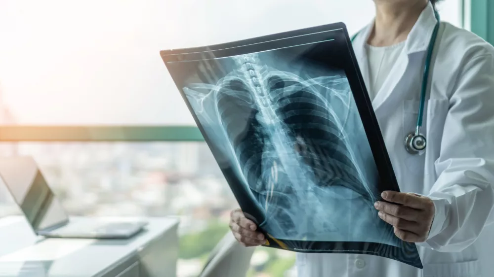 Doctor diagnosing patient&acirc;s health on asthma, lung disease, COVID-19 or bone cancer illness with radiological chest x-ray film for medical healthcare hospital service