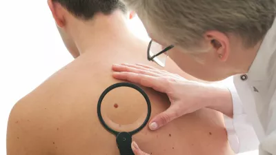 melanom, kožni rak, pregled kože.