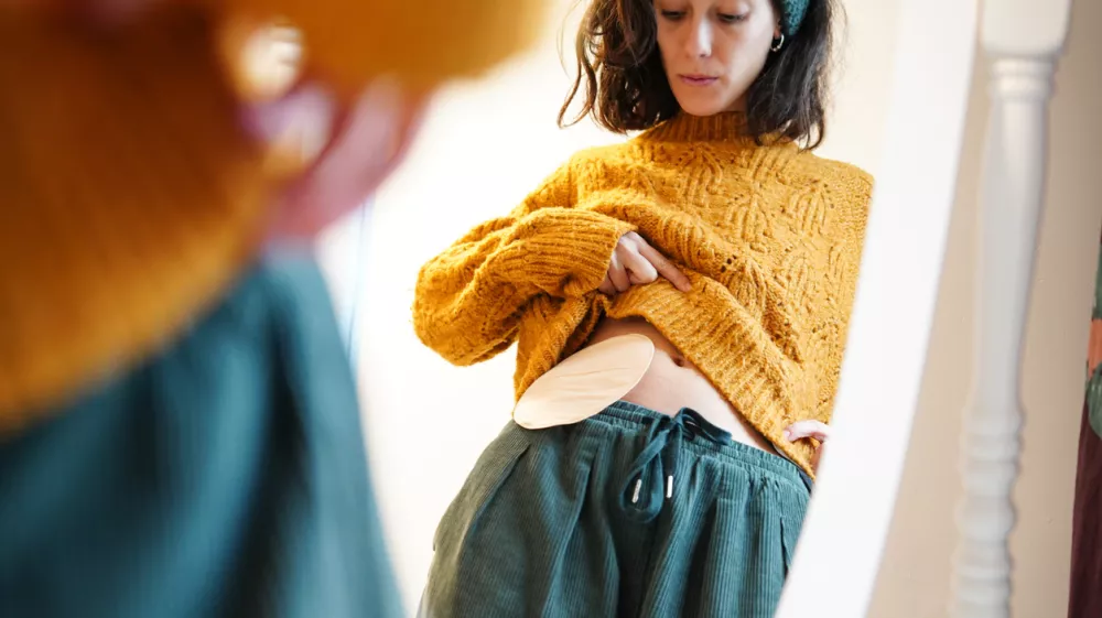 reflection of a woman looking at the ostomy bag in the mirror at home. colon cancer / Foto: Sheila Alonso Getty Images