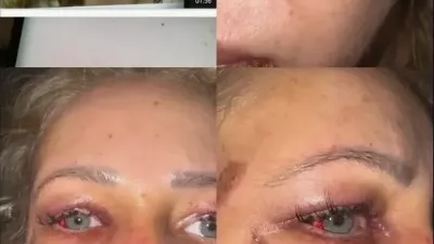 Kristina Živković je bila žrtev brutalnega napada nekdanjega partnerja. F instagram
