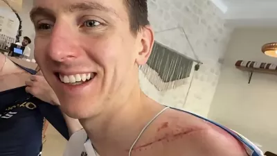 Posledice po&scaron;kodbe ob hudem padcu so &scaron;e vidne. / Foto: instagram Tadeja Pogačarja